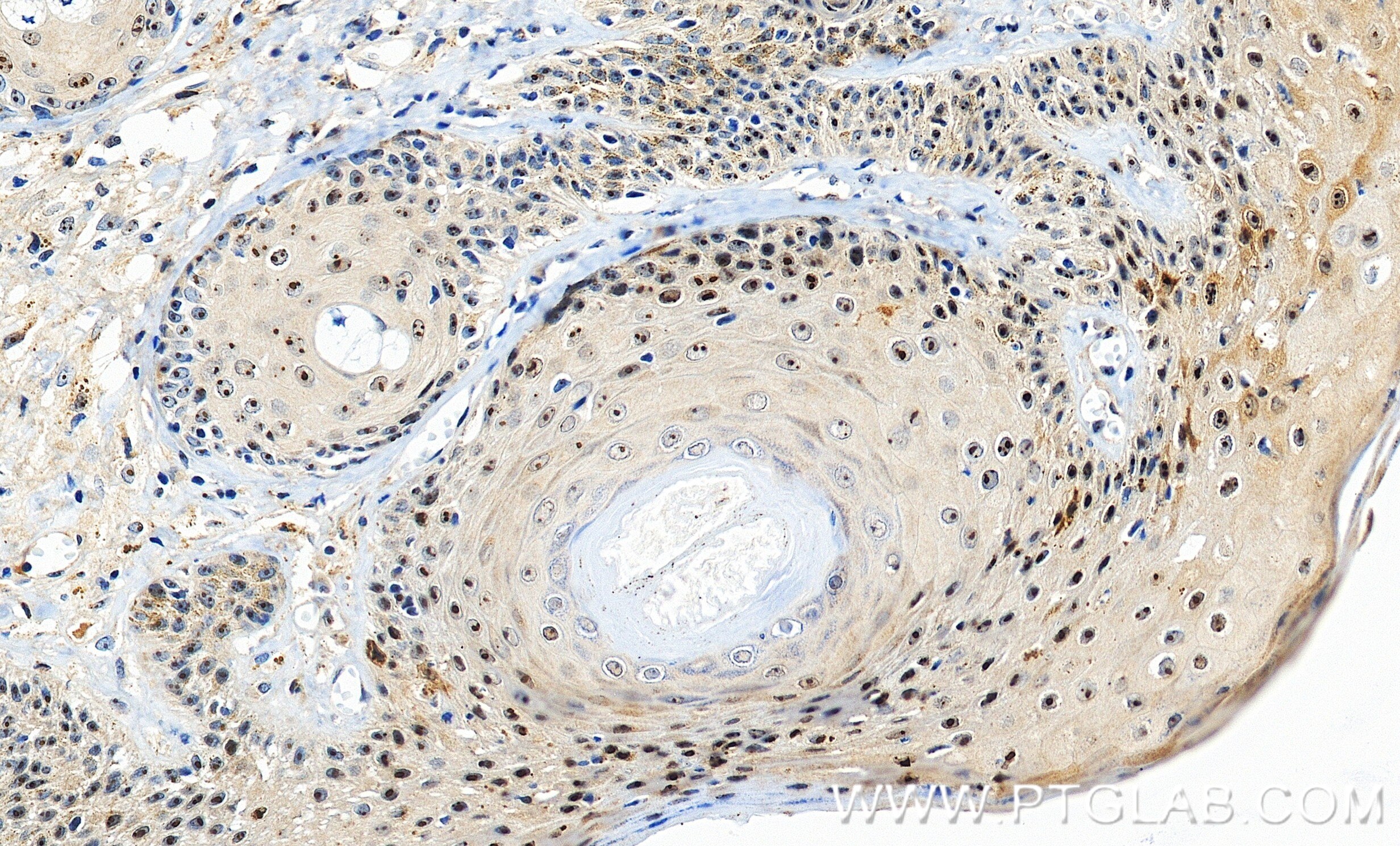 Immunohistochemistry (IHC) staining of human skin tissue using SECISBP2 Recombinant monoclonal antibody (86488-1-RR)