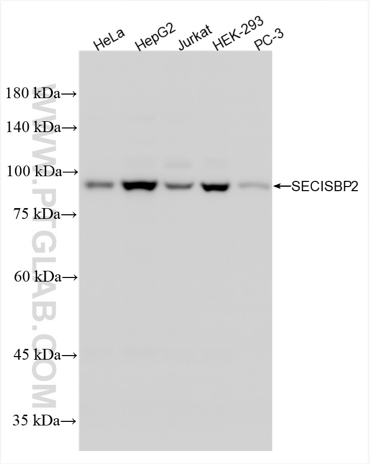 Western Blot (WB) analysis of various lysates using SECISBP2 Recombinant antibody (86488-1-RR)