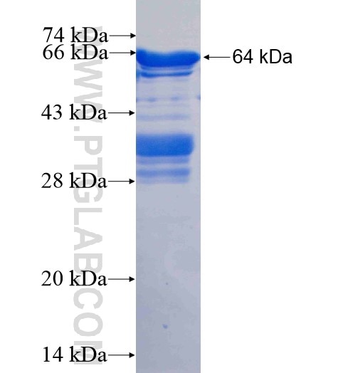 SECISBP2 fusion protein Ag3541 SDS-PAGE