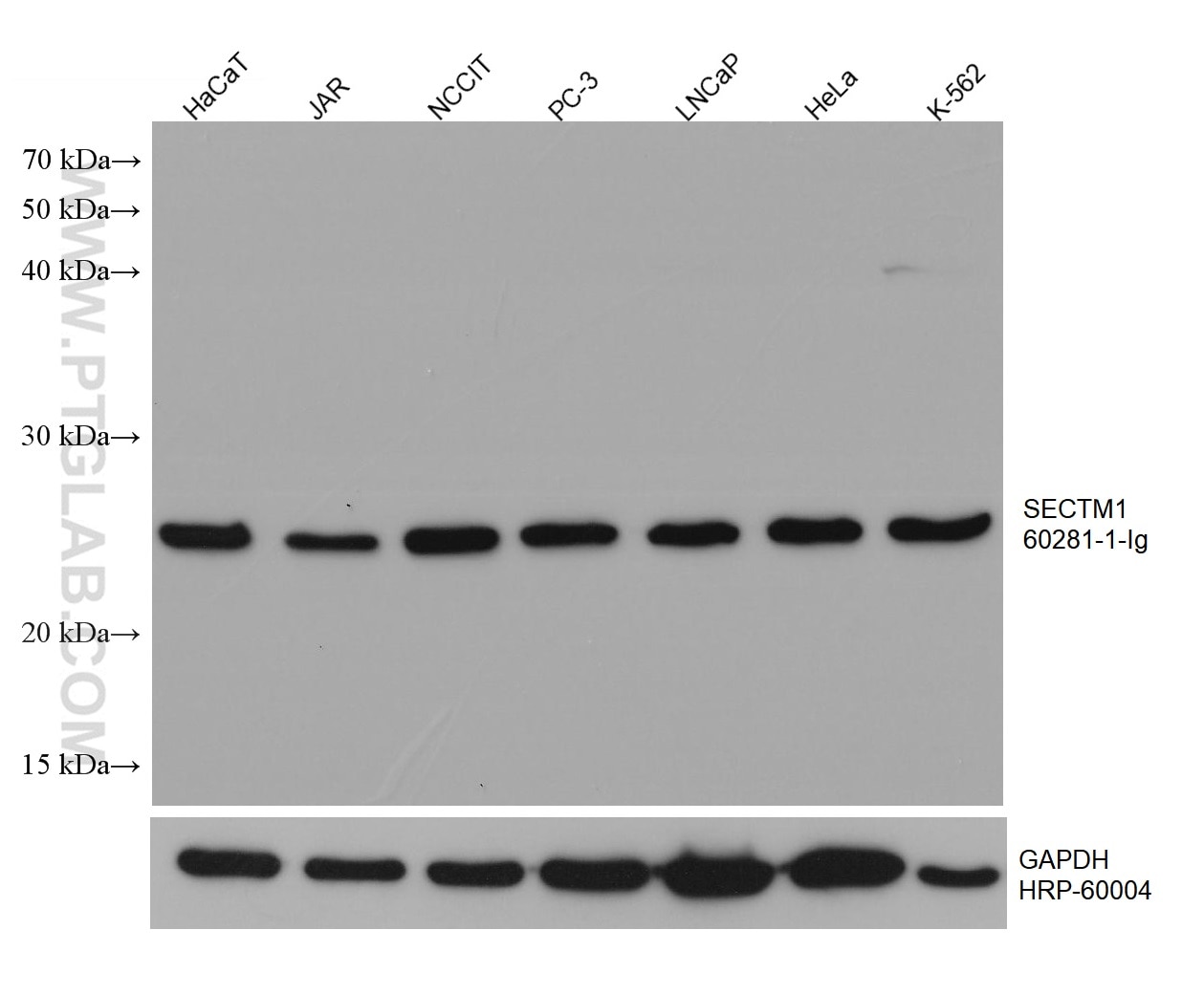 Western Blot (WB) analysis of various lysates using SECTM1 Monoclonal antibody (60281-1-Ig)