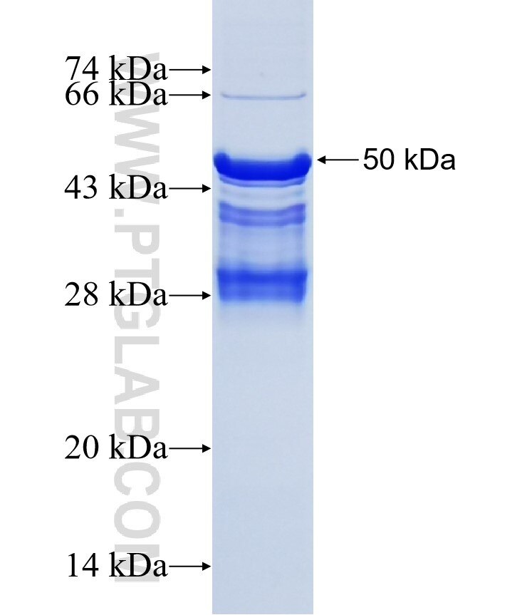 SECTM1 fusion protein Ag3190 SDS-PAGE