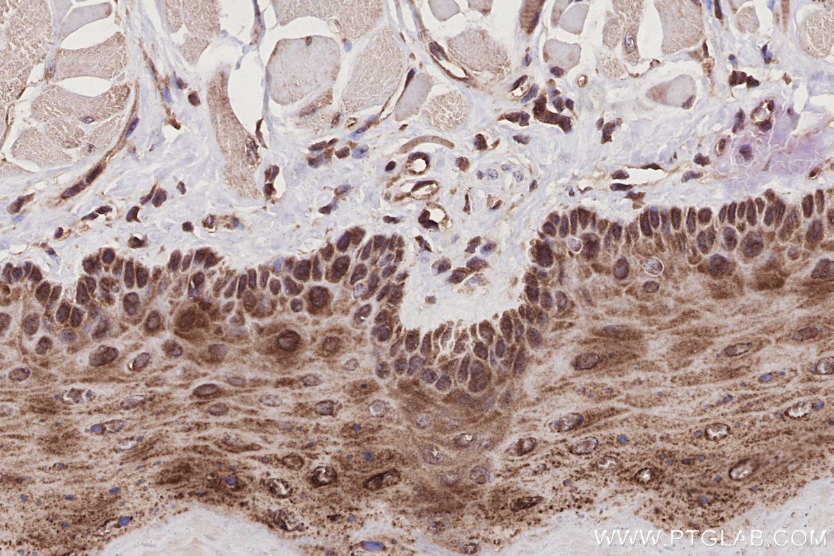 IHC staining of rat tongue using 15565-1-AP (same clone as 15565-1-PBS) Immunohistochemistry (IHC) staining of rat tongue tissue using SEH1L Polyclonal antibody (15565-1-AP)