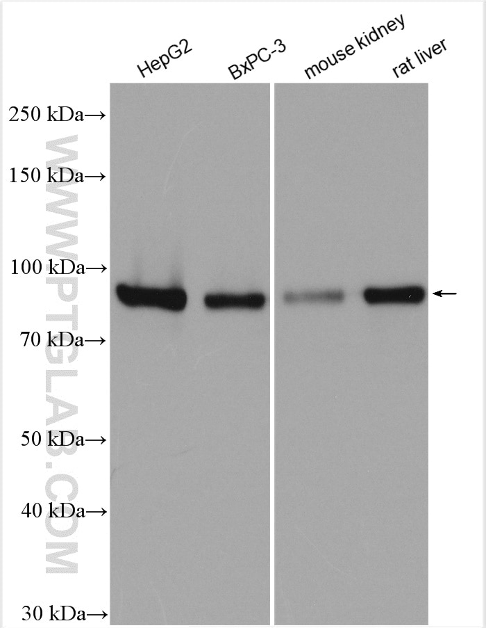 Western Blot (WB) analysis of various lysates using SEL1L Polyclonal antibody (29801-1-AP)