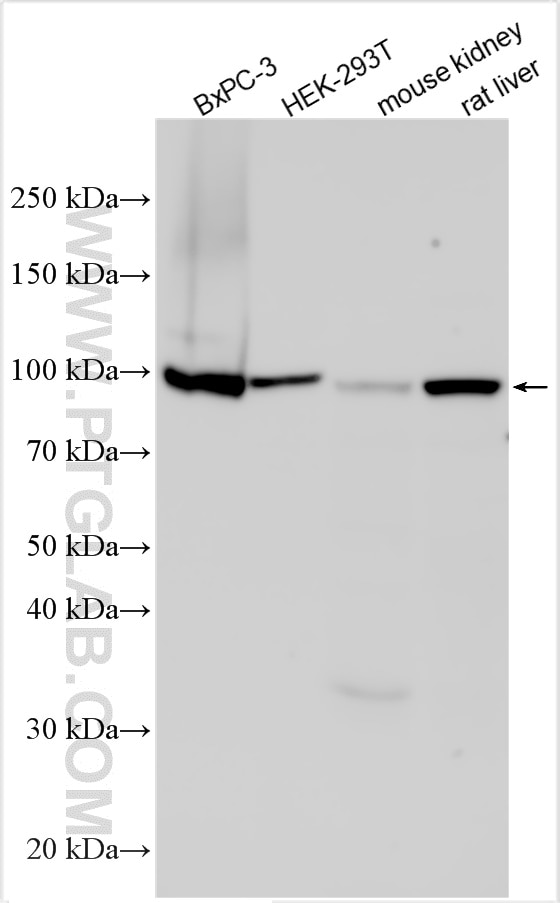 Western Blot (WB) analysis of various lysates using SEL1L Polyclonal antibody (29801-1-AP)