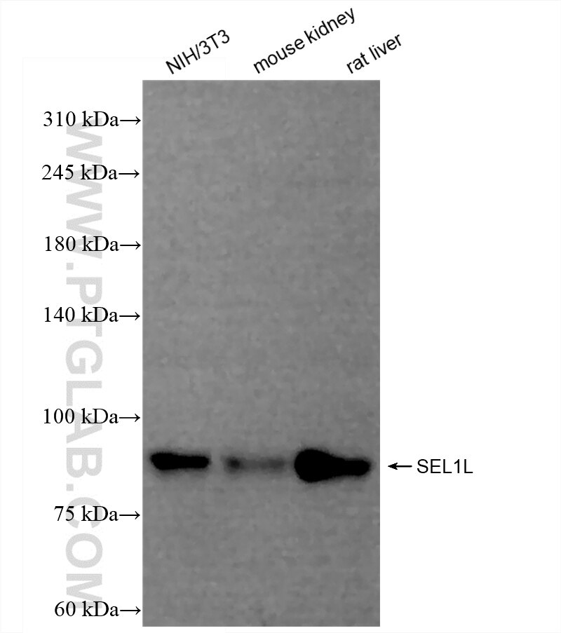Western Blot (WB) analysis of various lysates using SEL1L Recombinant antibody (84317-7-RR)