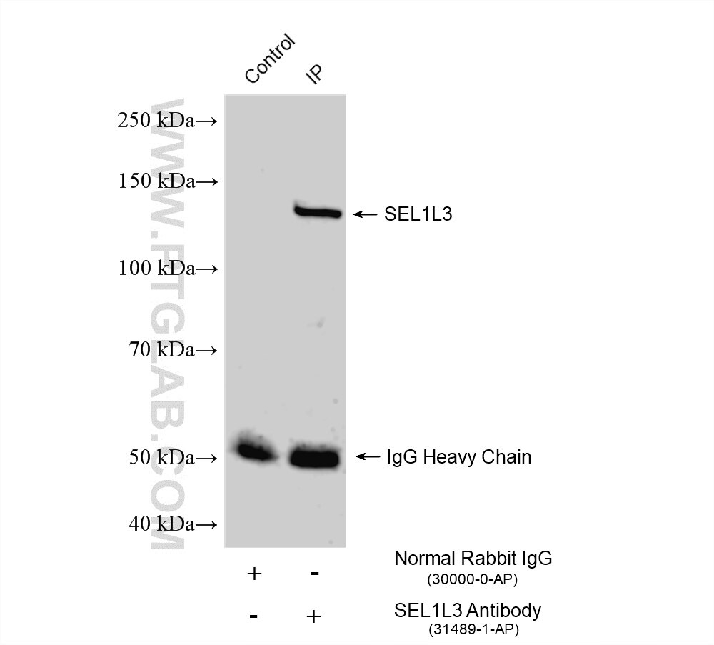 IP experiment of U-251 using 31489-1-AP Immunoprecipitation (IP) experiment of U-251 cells using SEL1L3 Polyclonal antibody (31489-1-AP)