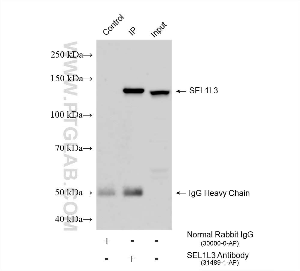 IP experiment of Daudi using 31489-1-AP Immunoprecipitation (IP) experiment of Daudi cells using SEL1L3 Polyclonal antibody (31489-1-AP)
