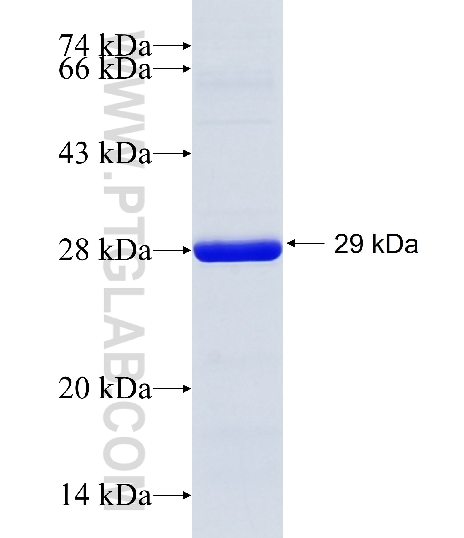 SEL1L3 fusion protein Ag34873 SDS-PAGE SEL1L3 fusion protein Ag34873 SDS-PAGE