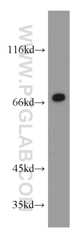 E-selectin /CD62E Polyclonal antibody