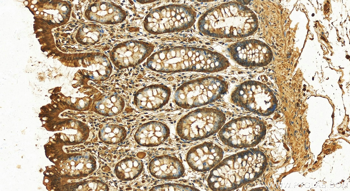 Immunohistochemistry (IHC) staining of human colon tissue using SELENBP1 Polyclonal antibody (27230-1-AP)