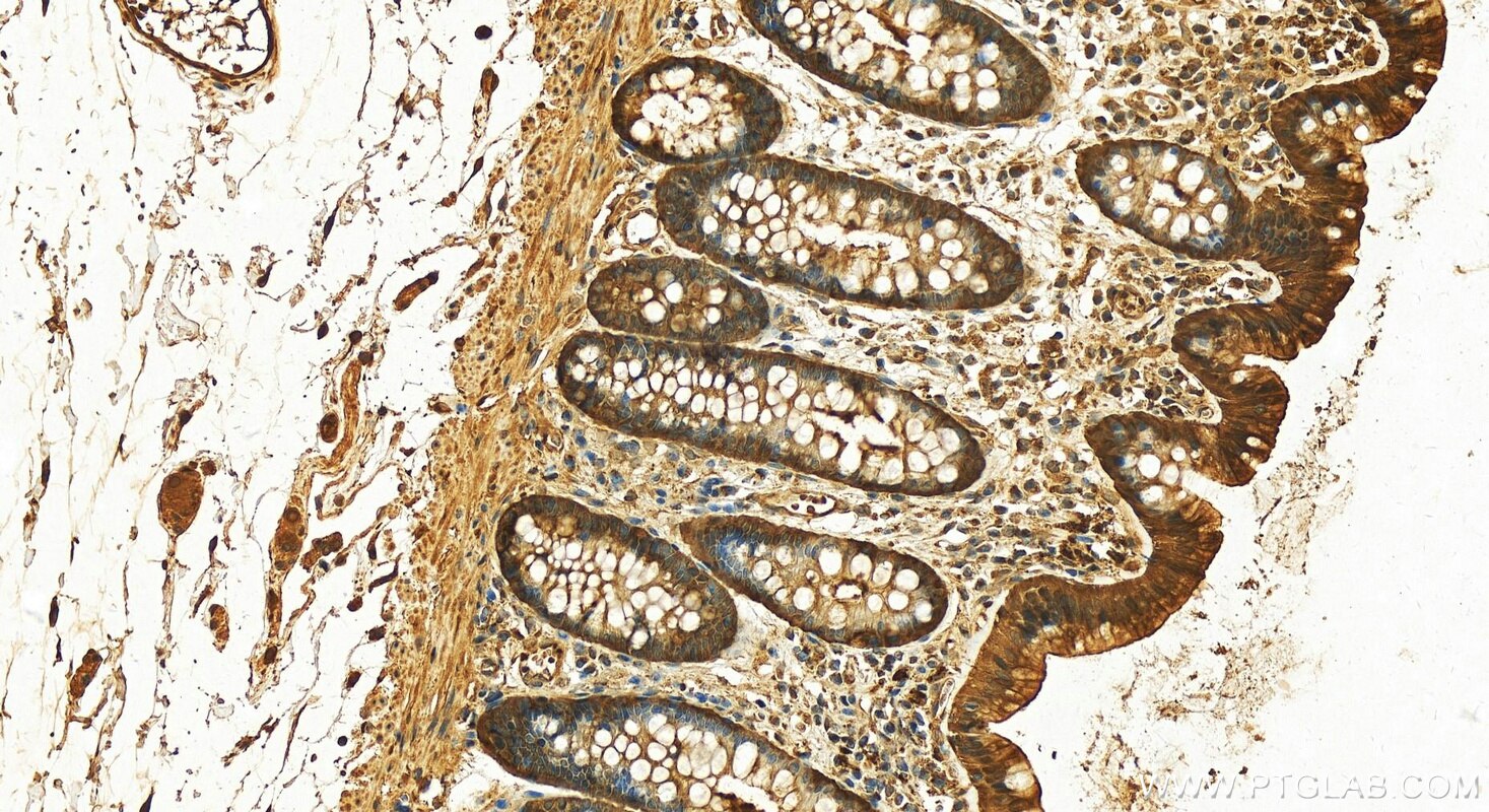 Immunohistochemistry (IHC) staining of human colon tissue using SELENBP1 Polyclonal antibody (27230-1-AP)