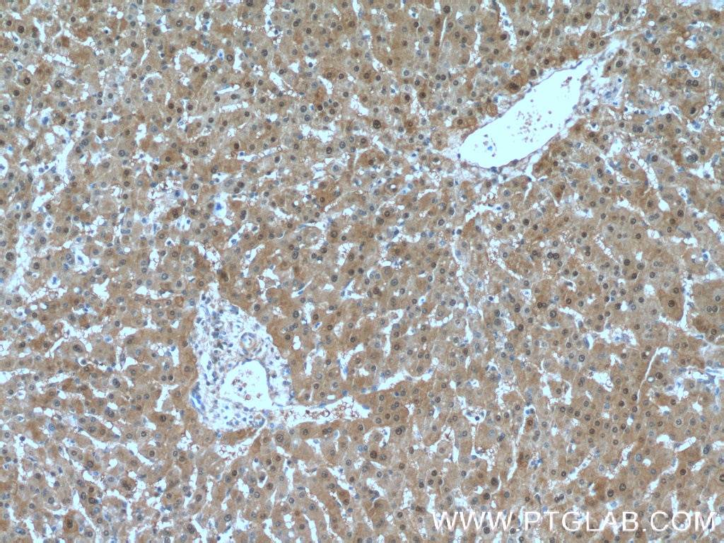 Immunohistochemistry (IHC) staining of human liver tissue using SELENBP1 Polyclonal antibody (27230-1-AP)