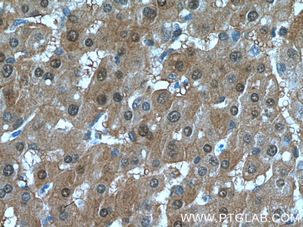 Immunohistochemistry (IHC) staining of human liver tissue using SELENBP1 Polyclonal antibody (27230-1-AP)
