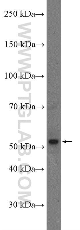 Western Blot (WB) analysis of A549 cells using SELENBP1 Polyclonal antibody (27230-1-AP)