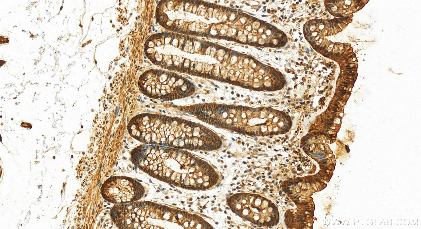 Immunohistochemistry (IHC) staining of human colon tissue using SELENBP1 Polyclonal antibody (27449-1-AP)