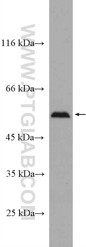 Western Blot (WB) analysis of HEK-293 cells using SELENBP1 Polyclonal antibody (27449-1-AP)