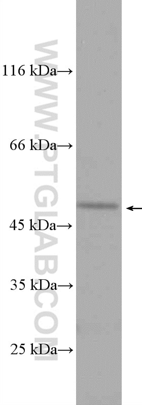 Western Blot (WB) analysis of mouse liver tissue using SELENBP1 Polyclonal antibody (27449-1-AP)