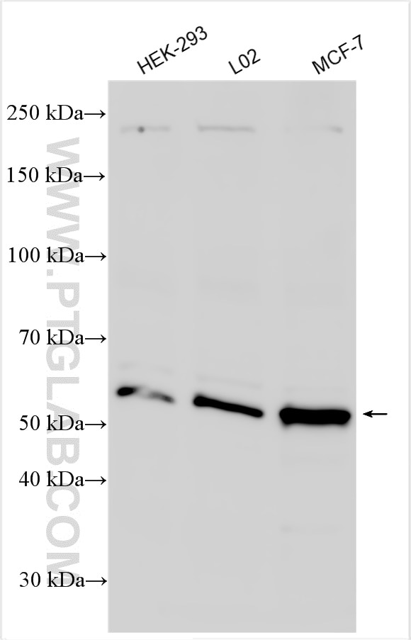 Western Blot (WB) analysis of various lysates using SELENBP1 Polyclonal antibody (27449-1-AP)