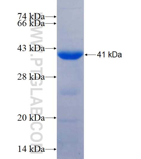 SELENBP1 fusion protein Ag20967 SDS-PAGE