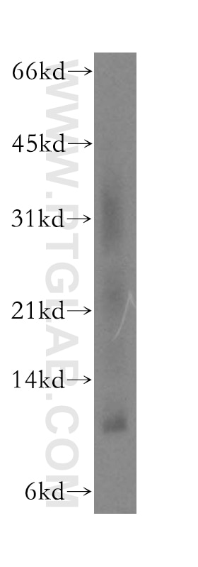 Western Blot (WB) analysis of K-562 cells using SELK Polyclonal antibody (12561-1-AP)