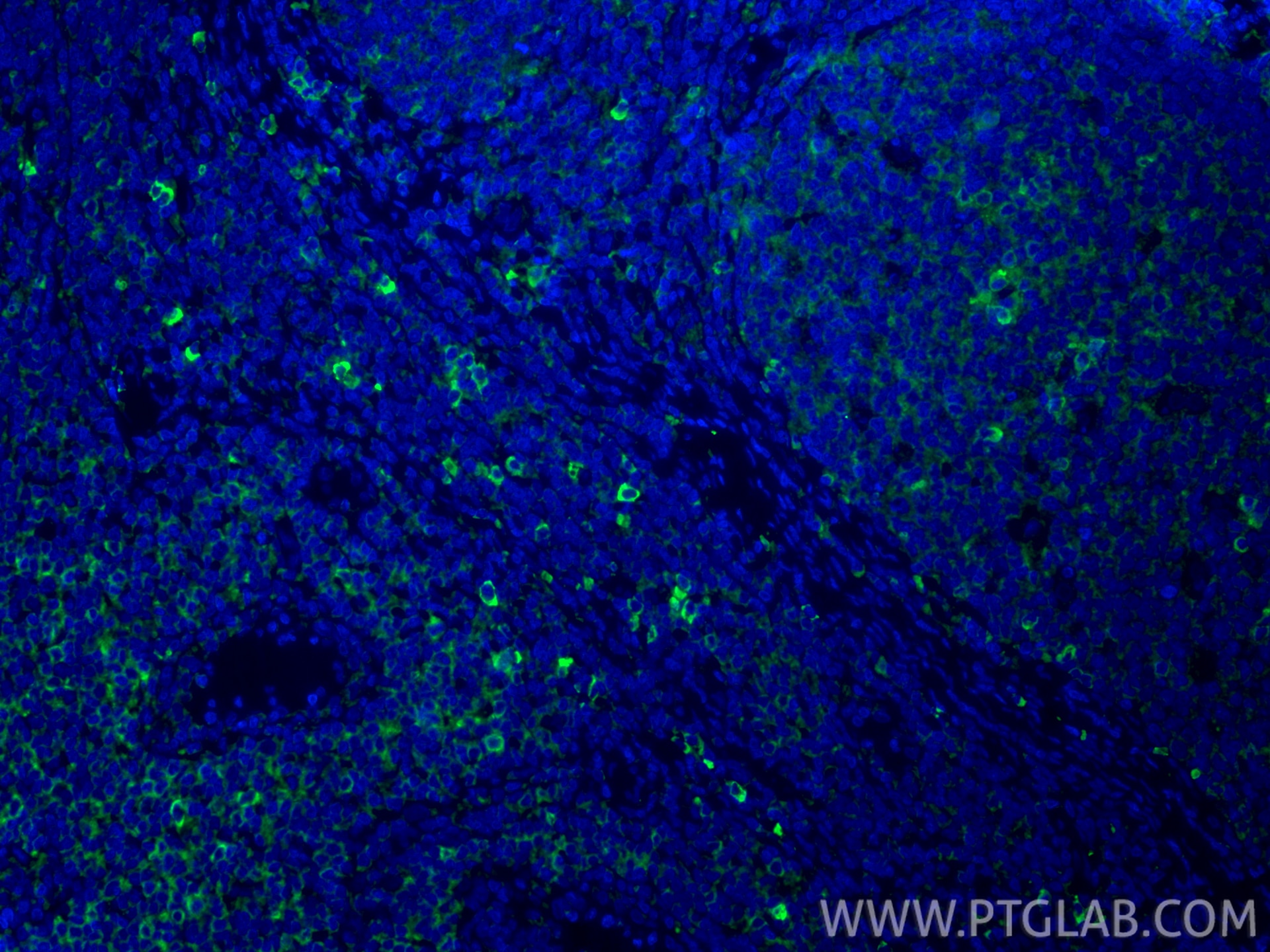 Immunofluorescence (IF) / fluorescent staining of human tonsillitis tissue using CD62L Polyclonal antibody (26477-1-AP)
