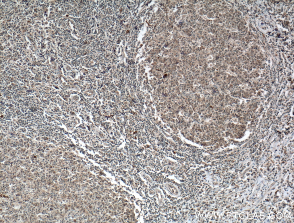 Immunohistochemistry (IHC) staining of human tonsillitis tissue using L-selectin / CD62L Polyclonal antibody (26477-1-AP)