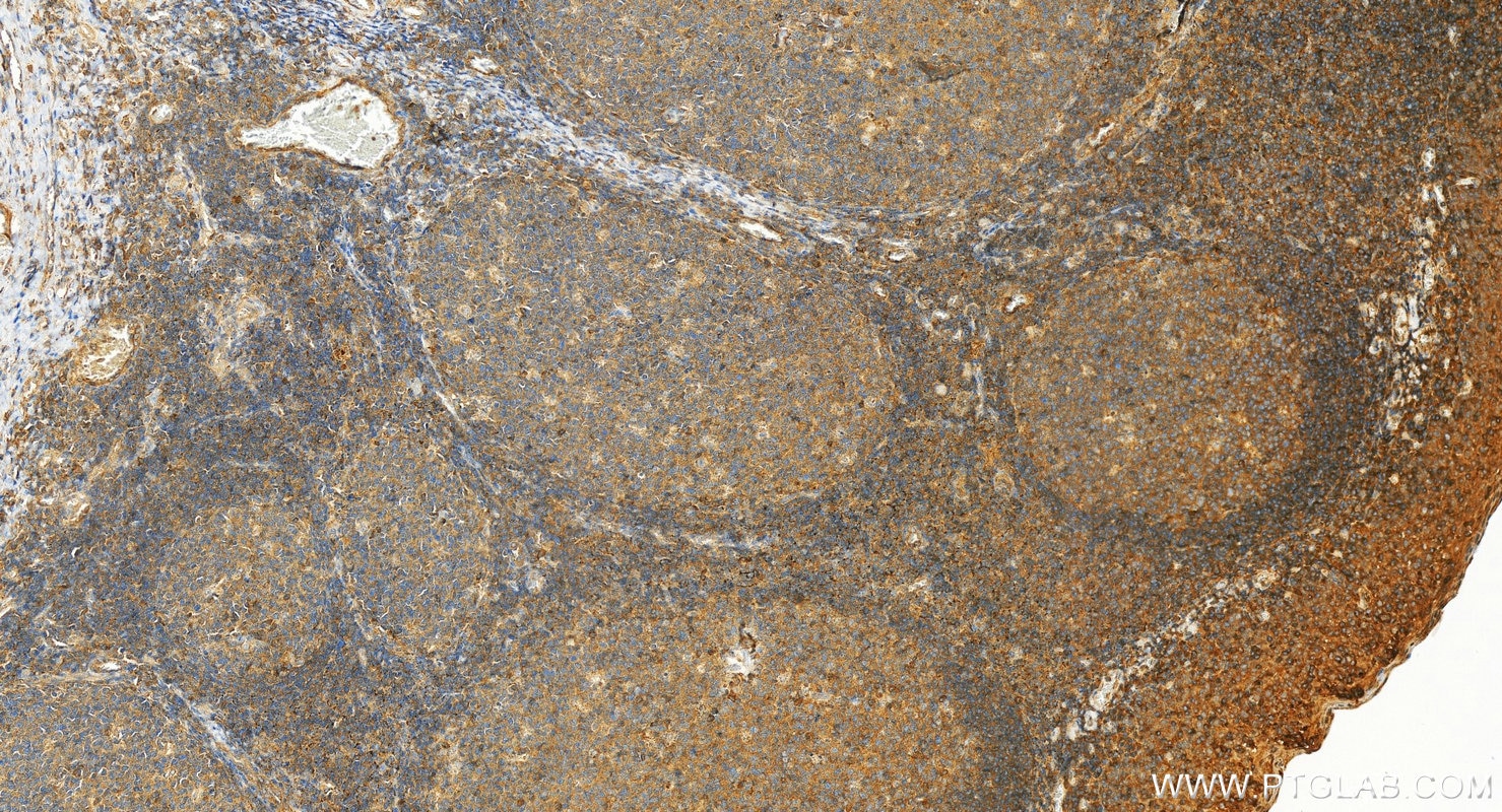 Immunohistochemistry (IHC) staining of human tonsillitis tissue using CD62L Polyclonal antibody (26477-1-AP)