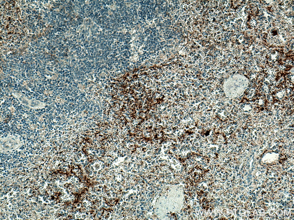 Immunohistochemistry (IHC) staining of human spleen tissue using P-selectin / CD62P Polyclonal antibody (13304-1-AP)