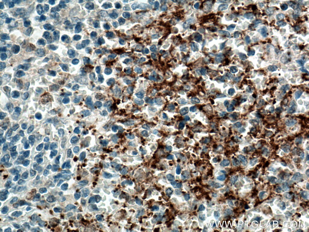 Immunohistochemistry (IHC) staining of human spleen tissue using P-selectin / CD62P Polyclonal antibody (13304-1-AP)