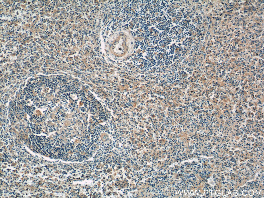 Immunohistochemistry (IHC) staining of human spleen tissue using P-selectin / CD62P Monoclonal antibody (60322-1-Ig)