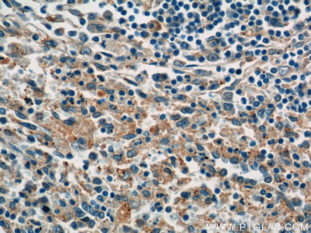 Immunohistochemistry (IHC) staining of human spleen tissue using P-selectin / CD62P Monoclonal antibody (60322-1-Ig)