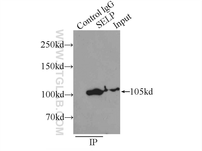 Immunoprecipitation (IP) experiment of K-562 cells using P-selectin / CD62P Monoclonal antibody (60322-1-Ig)