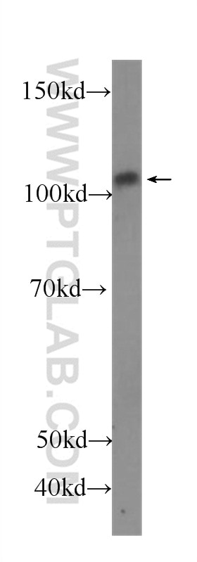 Western Blot (WB) analysis of Jurkat cells using P-selectin / CD62P Monoclonal antibody (60322-1-Ig)