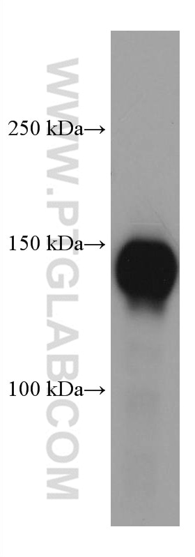 Western Blot (WB) analysis of human peripheral blood platelets using P-selectin / CD62P Monoclonal antibody (60322-1-Ig)