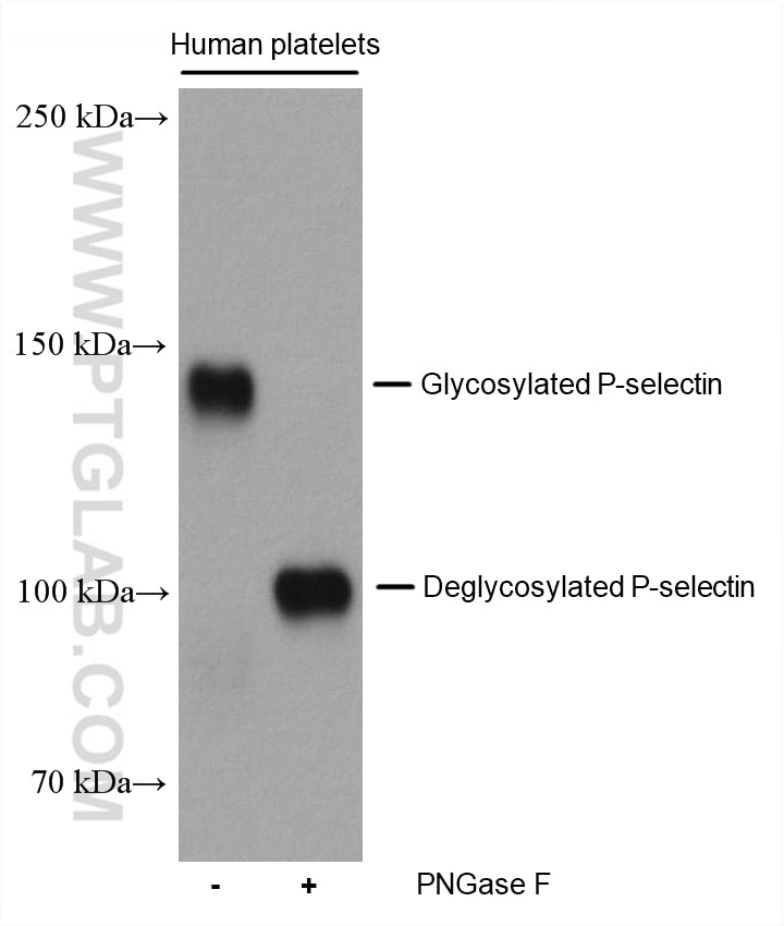 Western Blot (WB) analysis of various lysates using P-selectin / CD62P Monoclonal antibody (60322-1-Ig)
