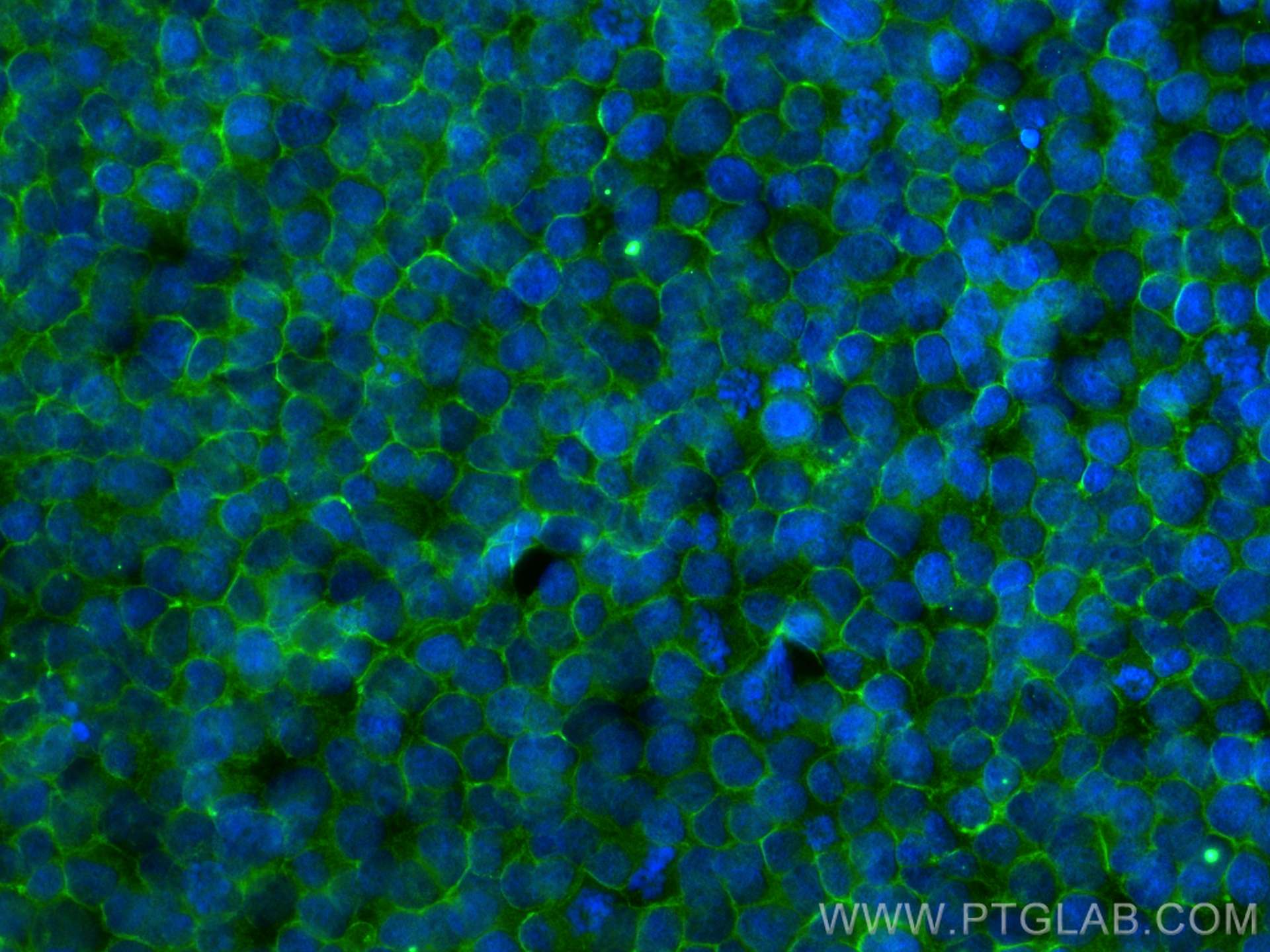 Immunofluorescence (IF) / fluorescent staining of Jurkat cells using SELPLG Polyclonal antibody (23605-1-AP)