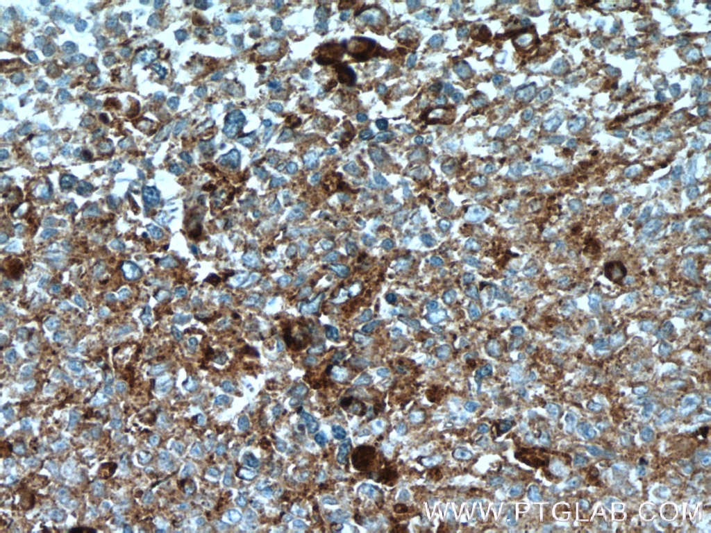 Immunohistochemistry (IHC) staining of human tonsillitis tissue using SELPLG Polyclonal antibody (23605-1-AP)