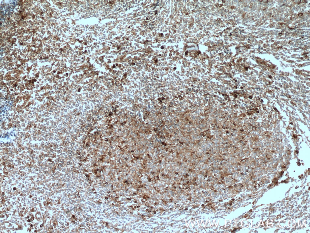 Immunohistochemistry (IHC) staining of human tonsillitis tissue using SELPLG Polyclonal antibody (23605-1-AP)