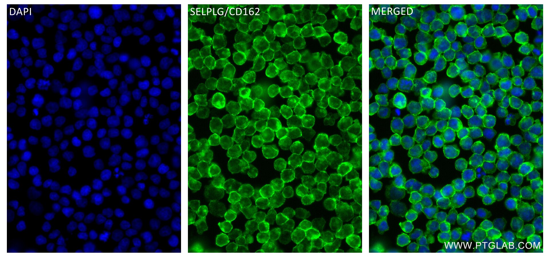 Immunofluorescence (IF) / fluorescent staining of Jurkat cells using SELPLG/CD162 Recombinant antibody (84500-1-RR)