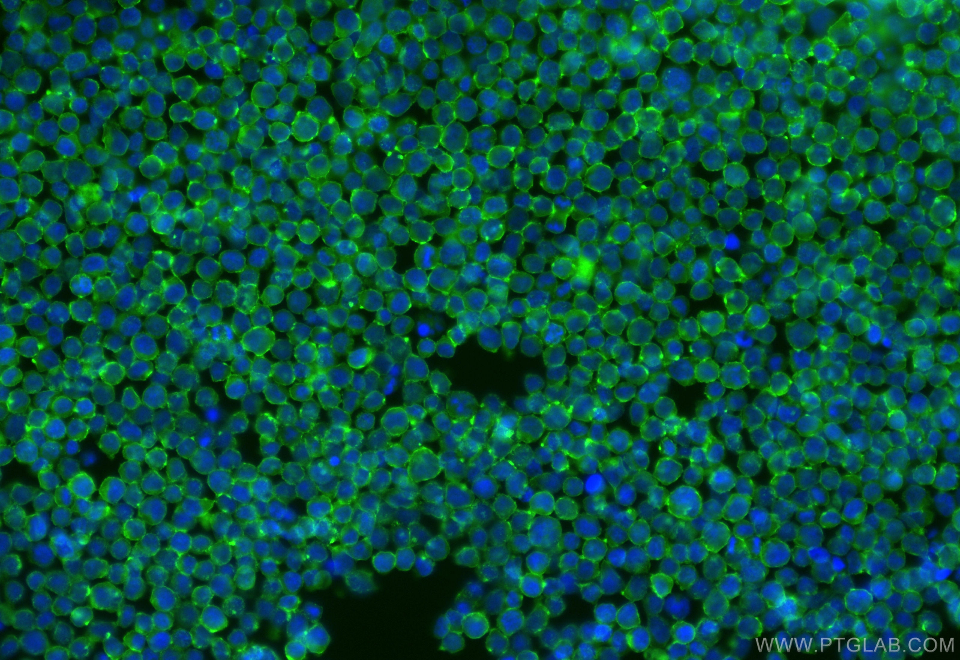 Immunofluorescence (IF) / fluorescent staining of Jurkat cells using CoraLite® Plus 488-conjugated SELPLG/CD162 Recombi (CL488-84500)