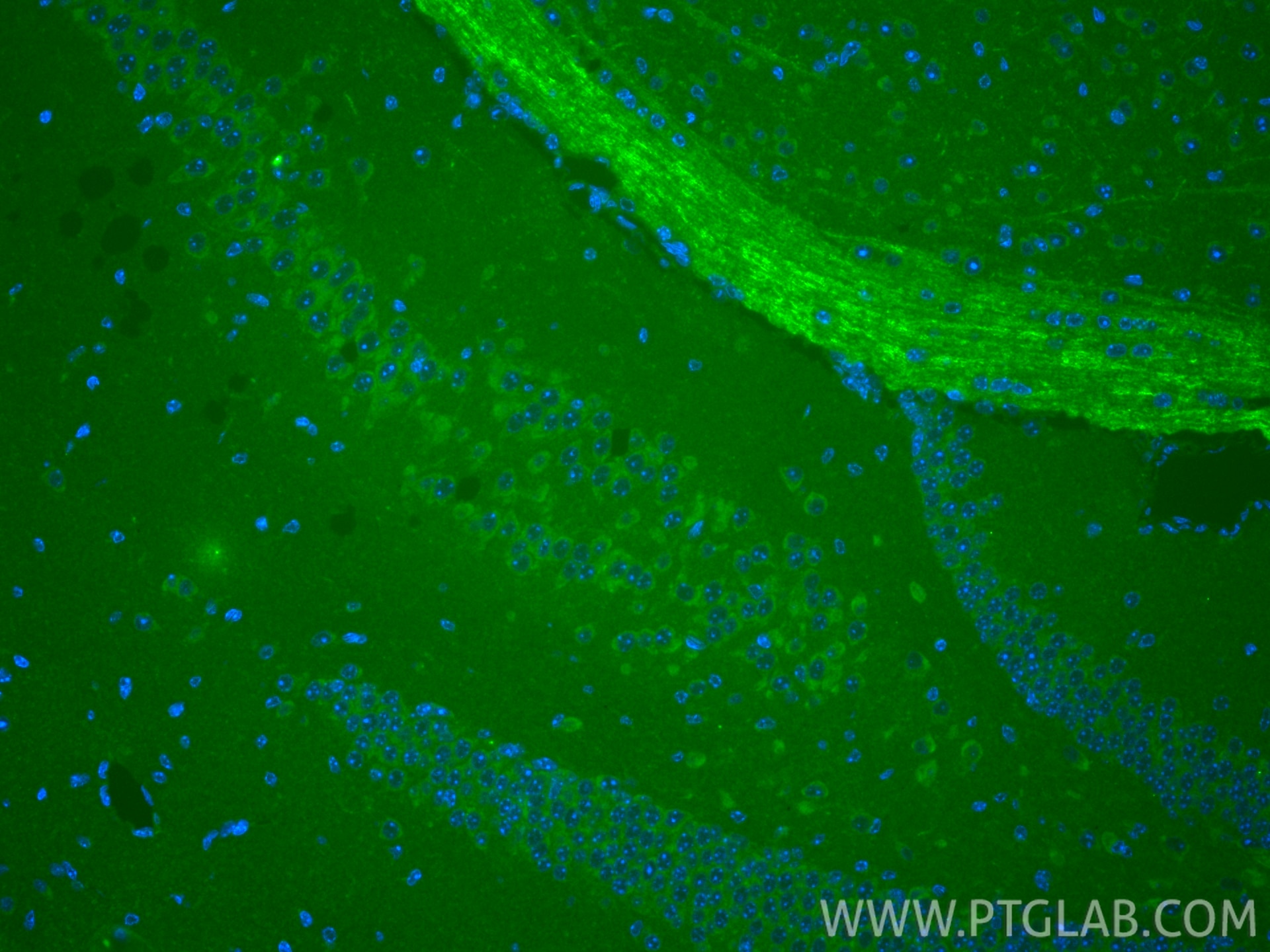 IF Staining of mouse brain using 15591-1-AP Immunofluorescence (IF) / fluorescent staining of mouse brain tissue using SELS Polyclonal antibody (15591-1-AP)