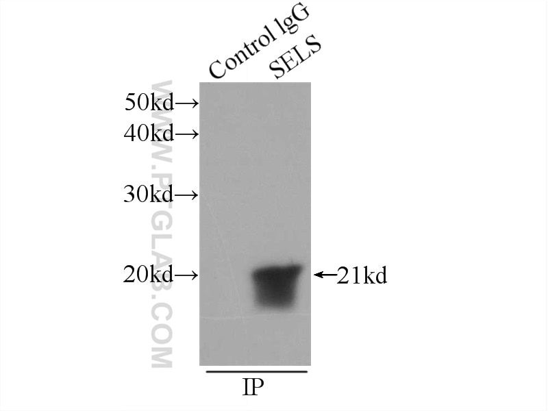 Immunoprecipitation (IP) experiment of HepG2 cells using SELS Polyclonal antibody (15591-1-AP)