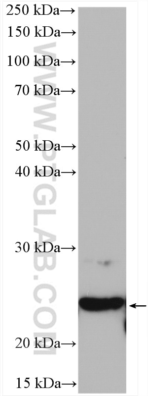 Western Blot (WB) analysis of mouse brain tissue using SELS Polyclonal antibody (15591-1-AP)