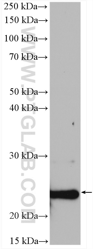 Western Blot (WB) analysis of rat brain tissue using SELS Polyclonal antibody (15591-1-AP)