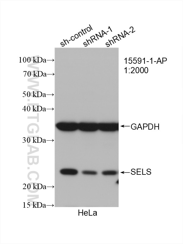 Western Blot (WB) analysis of HeLa cells using SELS Polyclonal antibody (15591-1-AP)