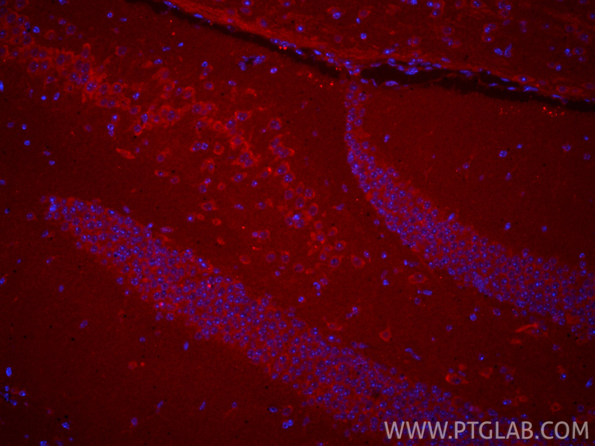 Immunofluorescence (IF) / fluorescent staining of mouse brain tissue using CoraLite®594-conjugated SELS Polyclonal antibody (CL594-15591)