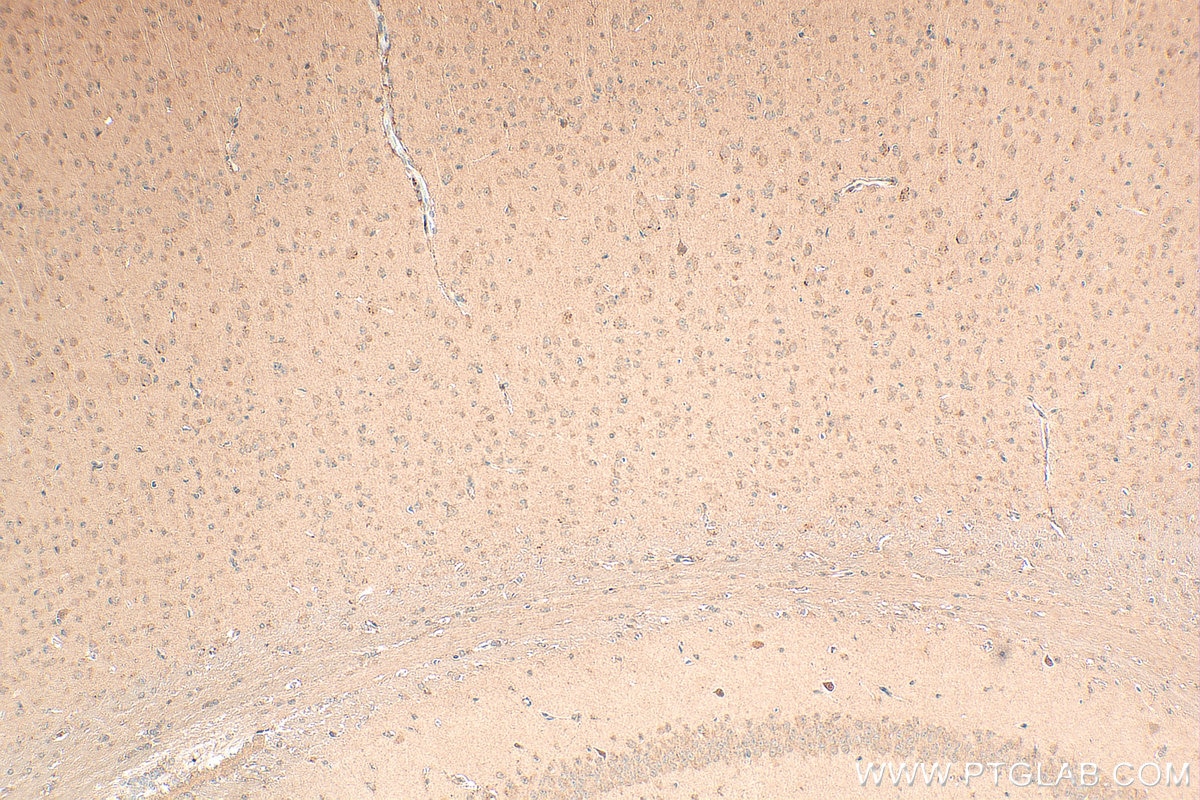IHC staining of mouse brain using 27836-1-AP Immunohistochemistry (IHC) staining of mouse brain tissue using SEMA3A Polyclonal antibody (27836-1-AP)