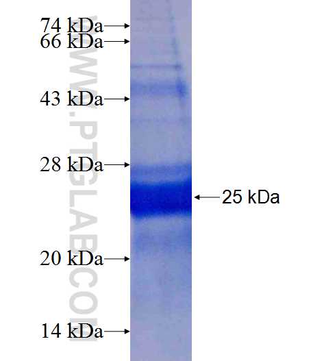SEMA3B fusion protein Ag25164 SDS-PAGE