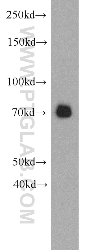 Western Blot (WB) analysis of mouse heart tissue using SEMA3C Polyclonal antibody (19242-1-AP)