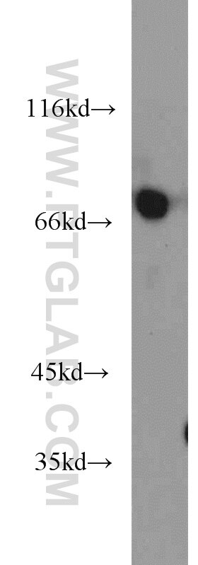 Western Blot (WB) analysis of mouse heart tissue using SEMA3C Polyclonal antibody (19242-1-AP)